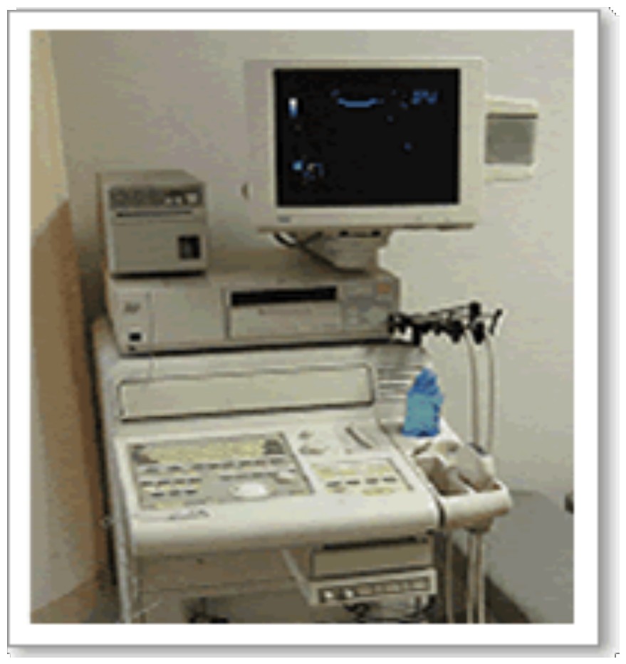 カラードップラー超音波検査装置